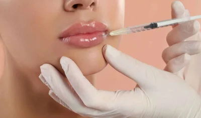 Filler i læberne Lip filler Filler Aarhus