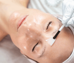 Fire and Ice frugtsyrebehandling