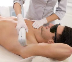 Permanent hårfjerning for mænd Hårfjerning på ryg